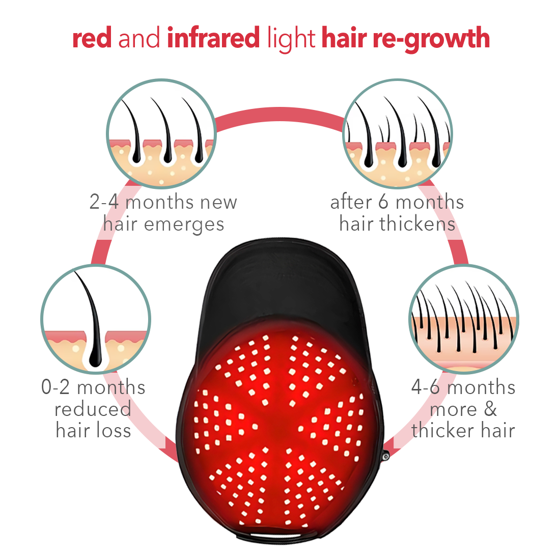 Regener8™ - LED Red Light Therapy Cap for Hair Regrowth
